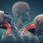 Боль в шее: причины, симптомы и лечение