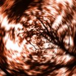 Современная диагностика головокружений