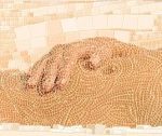 Паховая грыжа: стереотипы, сомнения, страхи